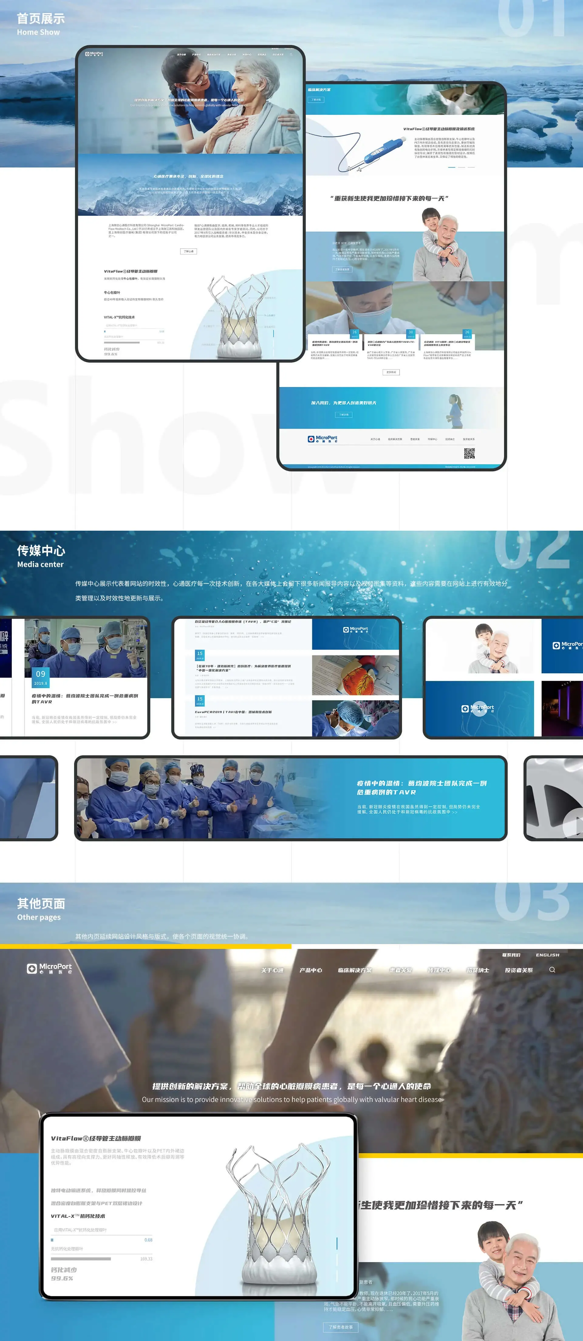 微创心通医疗应用设计研究